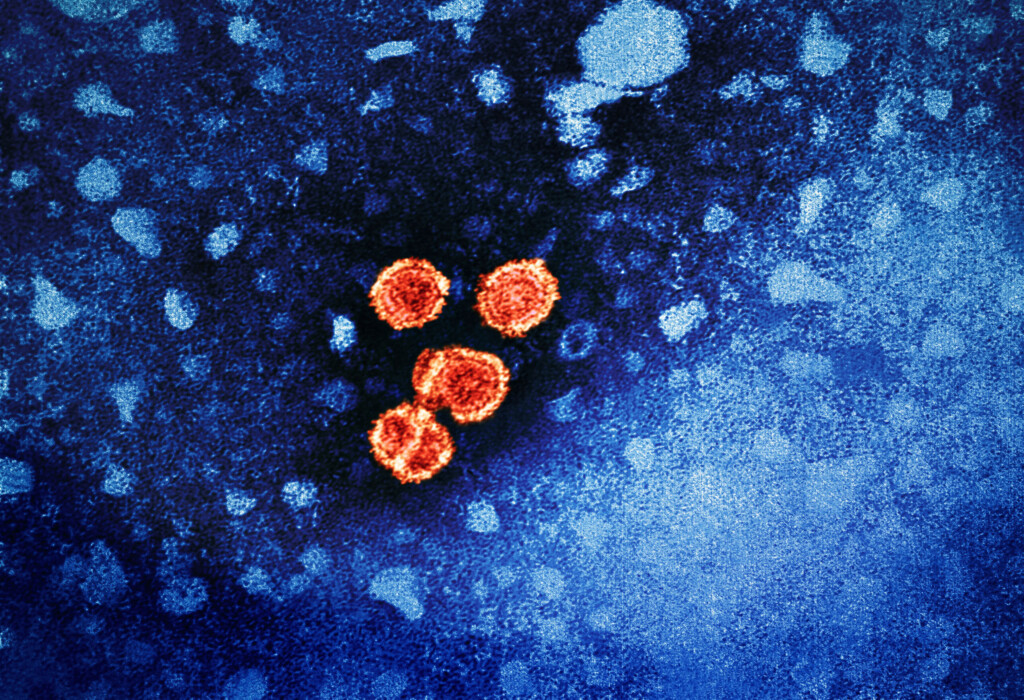 Three dose Hepatitis B Vaccine Regimen Protects People With HIV - Hepatitis B Vaccine Three Dose Schedule Regimen